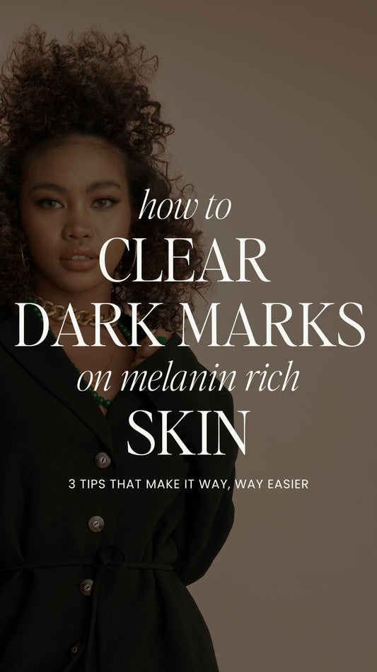 3 Tips For Clearing Dark Marks in Melanin Rich Skin