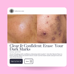 Clear and Confident: How To Erase Dark Marks and Get Even-Toned Skin Masterclass